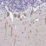 INTS5 Antibody in Immunohistochemistry (IHC)