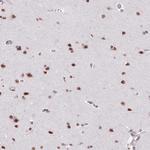 SRSF7 Antibody in Immunohistochemistry (Paraffin) (IHC (P))