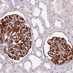 SRSF7 Antibody in Immunohistochemistry (Paraffin) (IHC (P))