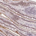 SRSF7 Antibody in Immunohistochemistry (Paraffin) (IHC (P))