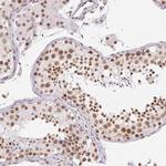 SRSF7 Antibody in Immunohistochemistry (Paraffin) (IHC (P))