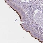 CCDC142 Polyclonal Antibody