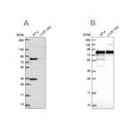 ENTH Antibody in Western Blot (WB)