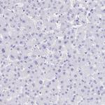 Ankyrin 1 Antibody in Immunohistochemistry (Paraffin) (IHC (P))