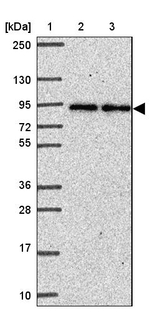 Ankyrin 1 Antibody in Western Blot (WB)