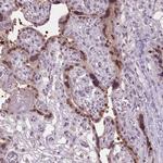 C2orf16 Polyclonal Antibody