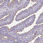 RUNDC3B Polyclonal Antibody