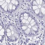 PSMB11 Antibody in Immunohistochemistry (IHC)