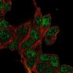 CLDND2 Polyclonal Antibody