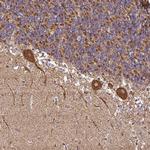 ANKRD33B Antibody in Immunohistochemistry (Paraffin) (IHC (P))