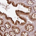 CCDC130 Antibody in Immunohistochemistry (Paraffin) (IHC (P))