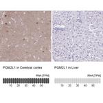 PGM2L1 Antibody