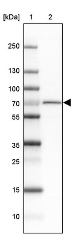 PGM2L1 Antibody in Western Blot (WB)