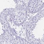 OXLD1 Polyclonal Antibody