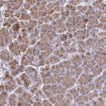 CCDC85A Polyclonal Antibody