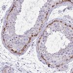 GRK4 Polyclonal Antibody