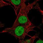 DHRS12 Polyclonal Antibody