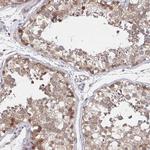 DHRS12 Antibody in Immunohistochemistry (Paraffin) (IHC (P))