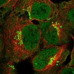 LPPR3 Polyclonal Antibody