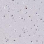 LPPR3 Antibody in Immunohistochemistry (Paraffin) (IHC (P))