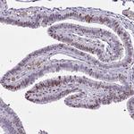 LPPR3 Antibody in Immunohistochemistry (Paraffin) (IHC (P))