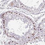 LPPR3 Antibody in Immunohistochemistry (Paraffin) (IHC (P))