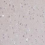 SLC7A10 Antibody in Immunohistochemistry (Paraffin) (IHC (P))