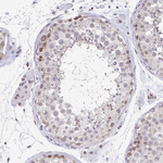 SLC7A10 Antibody in Immunohistochemistry (Paraffin) (IHC (P))