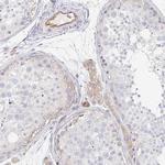 TSPAN19 Polyclonal Antibody