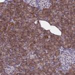 WBP1 Antibody in Immunohistochemistry (Paraffin) (IHC (P))