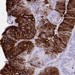 TNFAIP8 Antibody in Immunohistochemistry (Paraffin) (IHC (P))