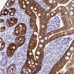 TNFAIP8 Antibody in Immunohistochemistry (Paraffin) (IHC (P))