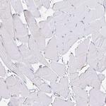 TNFAIP8 Antibody in Immunohistochemistry (Paraffin) (IHC (P))