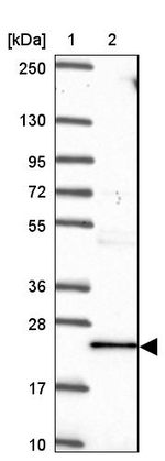 TNFAIP8 Antibody in Western Blot (WB)