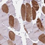 RASL10B Antibody in Immunohistochemistry (Paraffin) (IHC (P))