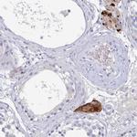 NT5C3B Antibody in Immunohistochemistry (Paraffin) (IHC (P))