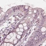 SAT2 Antibody in Immunohistochemistry (IHC)