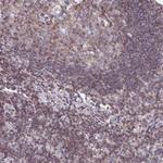 AP5M1 Polyclonal Antibody