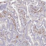 SSH2 Polyclonal Antibody