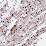TMEM86A Antibody in Immunohistochemistry (Paraffin) (IHC (P))