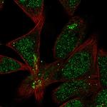 TMEM86A Polyclonal Antibody