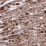 SYNPO2L Antibody in Immunohistochemistry (Paraffin) (IHC (P))