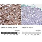 SYNPO2L Antibody