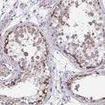 ZNF778 Polyclonal Antibody