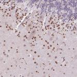 TMEM175 Antibody in Immunohistochemistry (Paraffin) (IHC (P))
