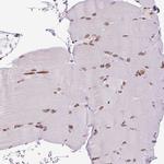 TMEM175 Antibody in Immunohistochemistry (Paraffin) (IHC (P))