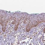 TMEM175 Antibody in Immunohistochemistry (Paraffin) (IHC (P))