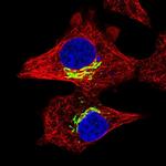 RFK Polyclonal Antibody