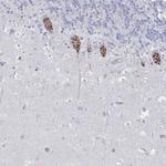 PSMG1 Antibody in Immunohistochemistry (Paraffin) (IHC (P))