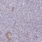 PSMG1 Antibody in Immunohistochemistry (Paraffin) (IHC (P))